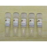 碧云天Kanamycin (10mg/ml,1000X)5ml