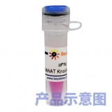 碧云天 ADRB2基因敲除慢病毒(L00107)