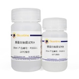 碧云天 细胞膜蛋白与细胞浆蛋白提取试剂盒(P0033)