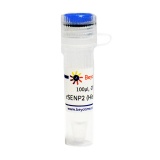 碧云天 重组SENP2蛋白酶(His-tag)(P2313-10KU)
