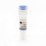 碧云天 ACTH(1-24) human (人促肾上腺皮质激素, 1-24)(P9019-1mg)
