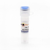 碧云天 ACTH(18-39) human (人促肾上腺皮质激素, 18-39)(P9028-1mg)